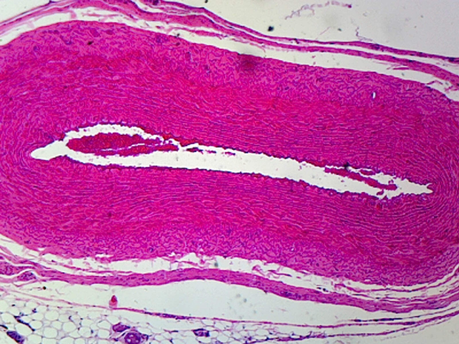 Capillary from Omentum, Mammalian; Whole-mount