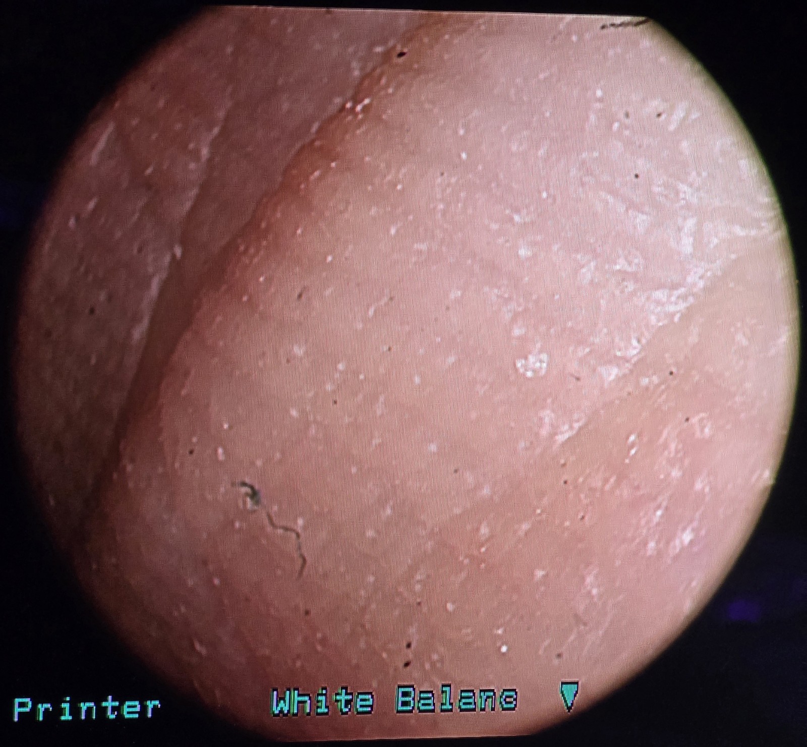 Storz 22220132 Image1 P3 NTSC Camera SN HA752199-H