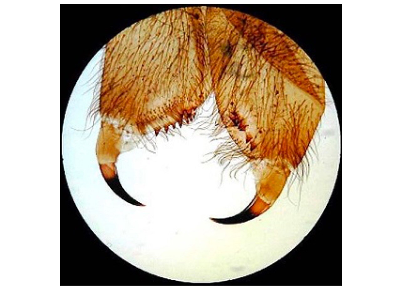 AmScope PS100A 100 Homeschool Biology Prepared Microscope Slides - Set A