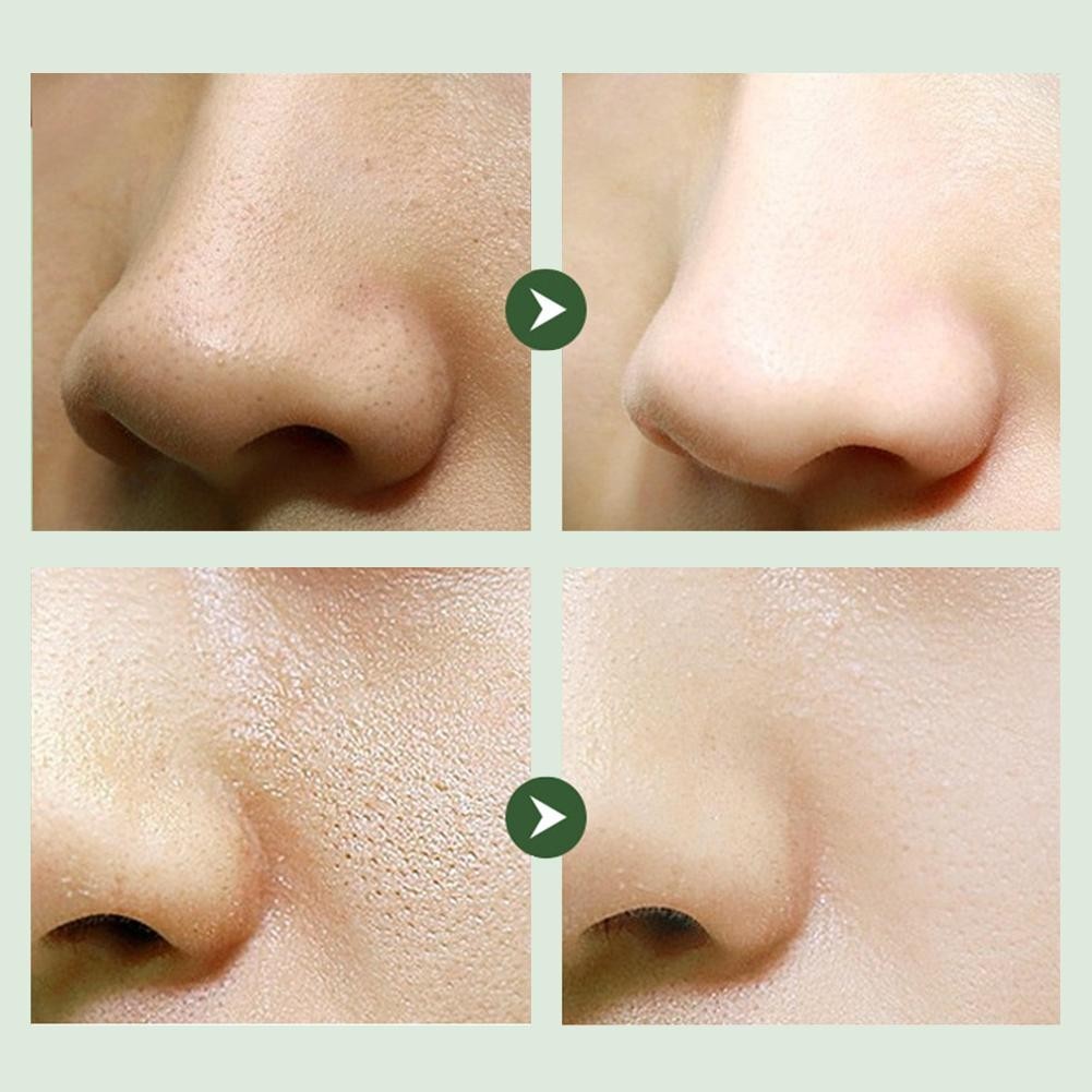 12pcs Bubble Face Sheet Masque Centella Bubble Mask (green)- Oil Control J5O6