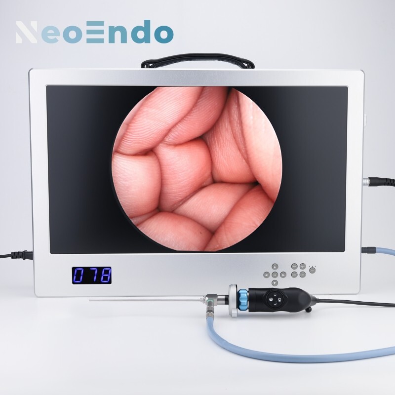 Full HD Endoscope Camera With 24 Inch Monitor 80W LED Light Source With Recorder