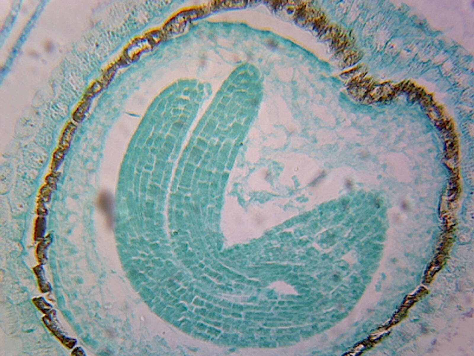 Capsella Embryo, Later Cotyledon Stage; Longitudinal Section