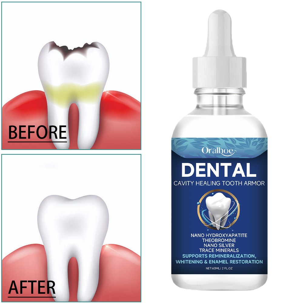 60ml Dental Cavity Healing Tooth Armor Liquid Tooth Care Helps Keep Gums Healthy