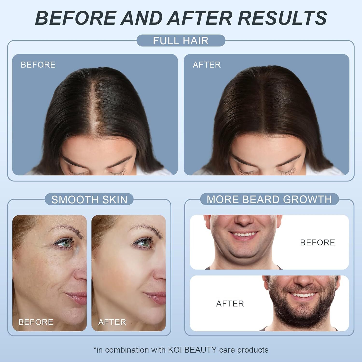 Microneedle Derma Stamp - Microneedling Micro Needling for Face Body