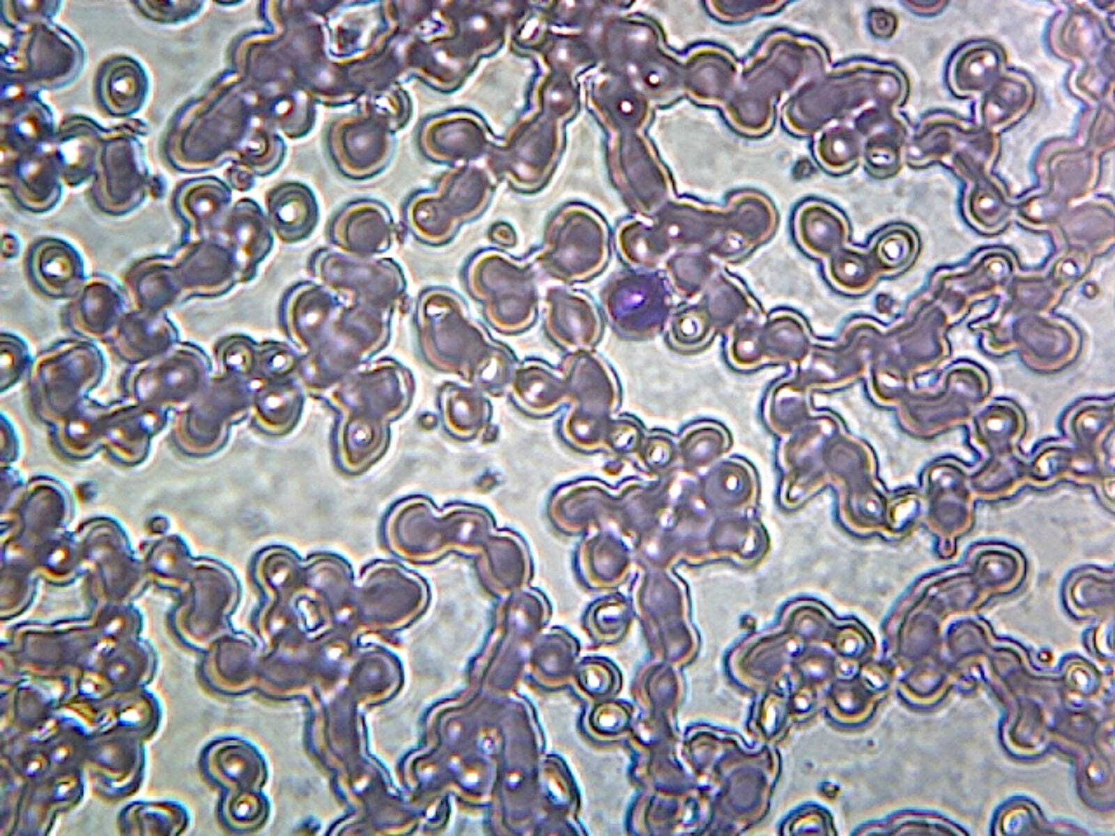 Iron-Deficient Anemia Blood (Human); Smear; GS Stain; Showing Peripheral Blood
