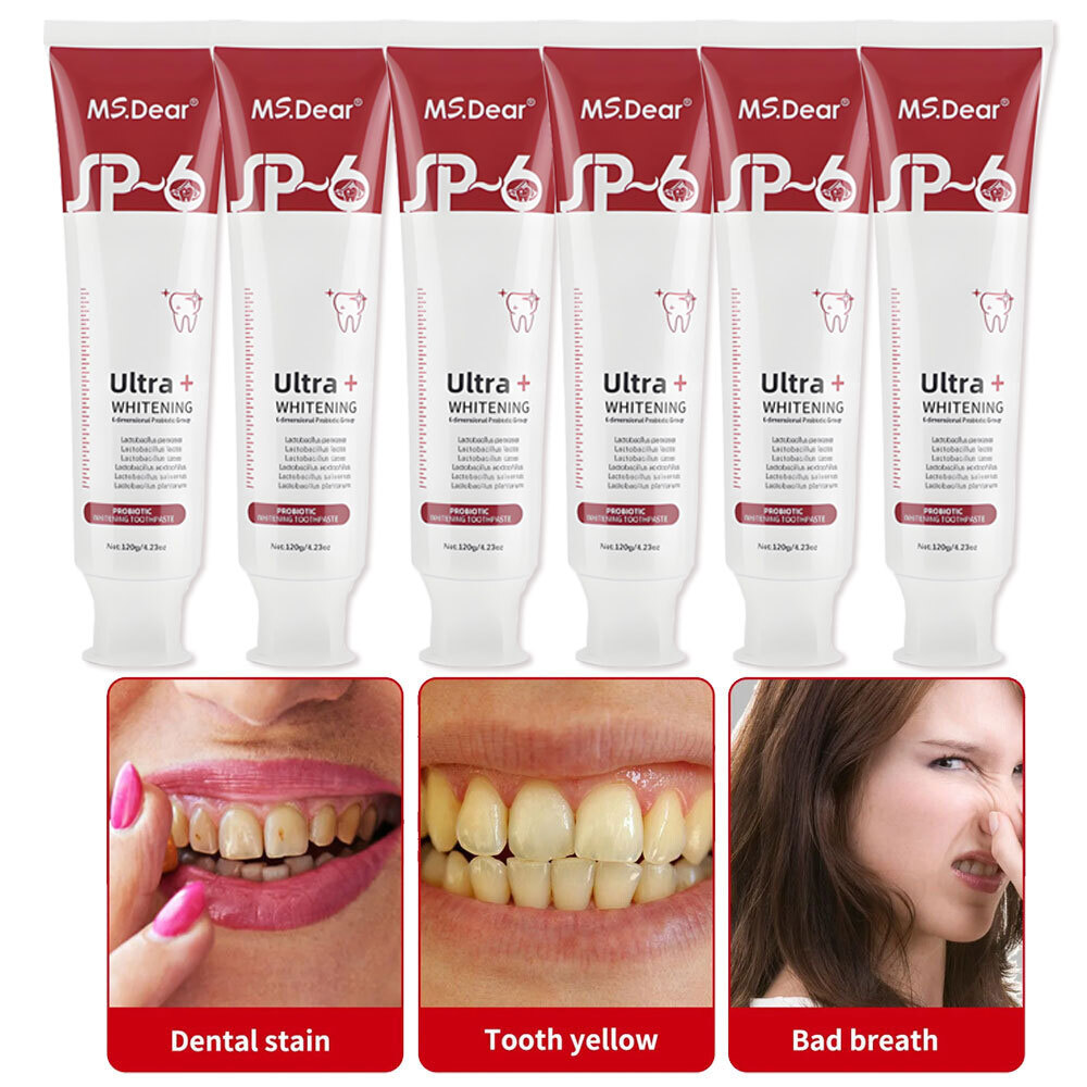 Sp 6 Probiotic Toothpaste Sp-6 Ultra Whitening Toothpaste Bad Breath Removing