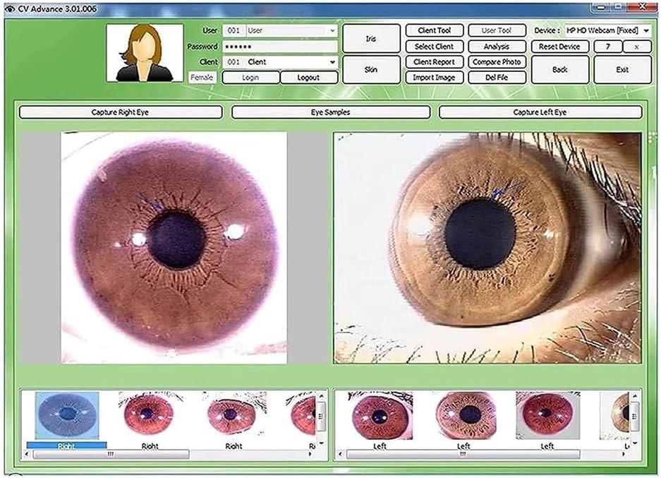5.0MP USB Iris Analysis Camera Eyes Analyzer Iridology English/Spanish Software