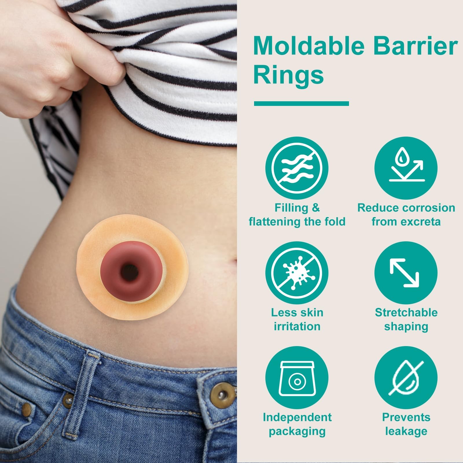 Ostomy Barrier Rings - Outer Diameter 2" 10PCS Rings, Beige