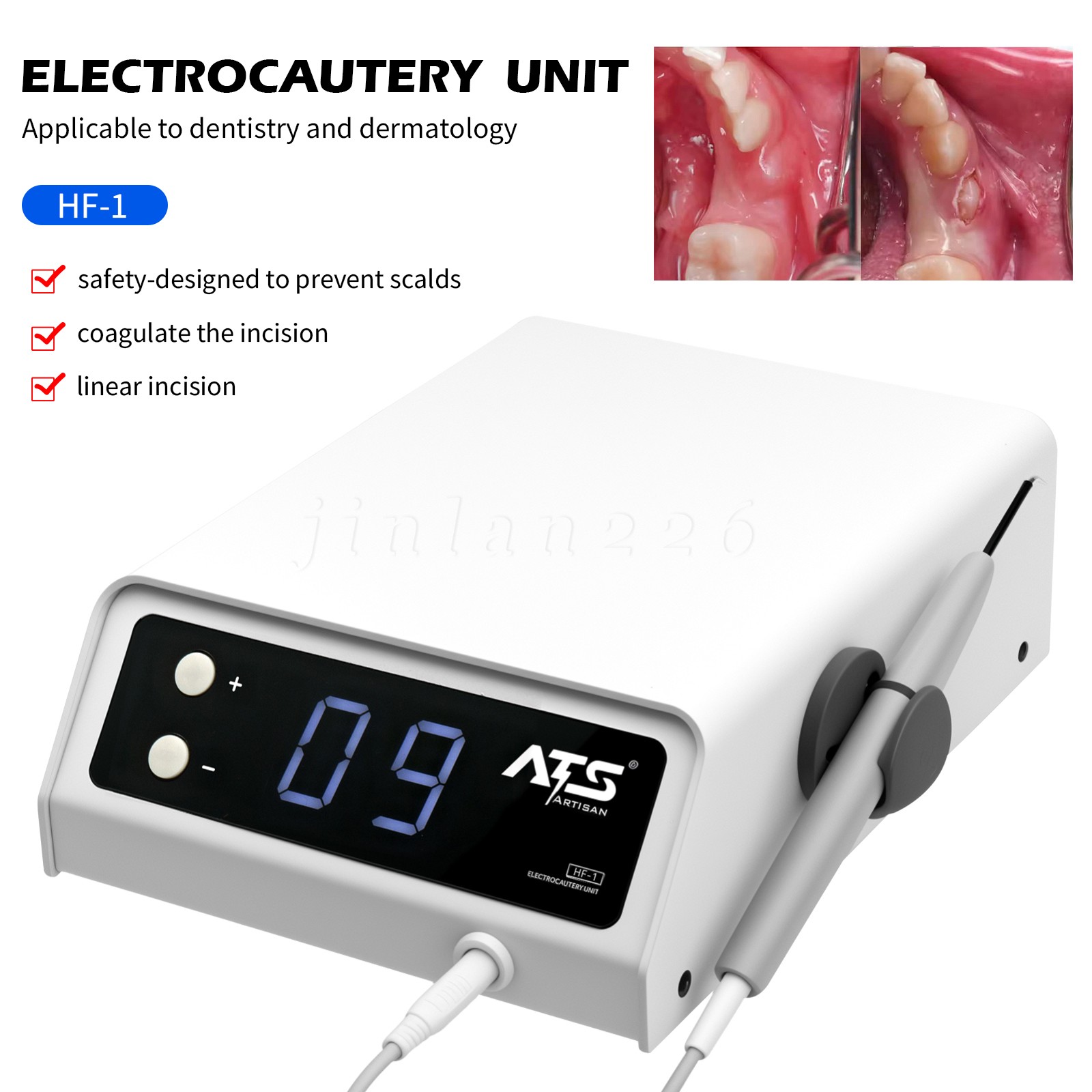 Dental Electro Electrosurgery Unit Machine High Frequency Electric 10pcs Knife