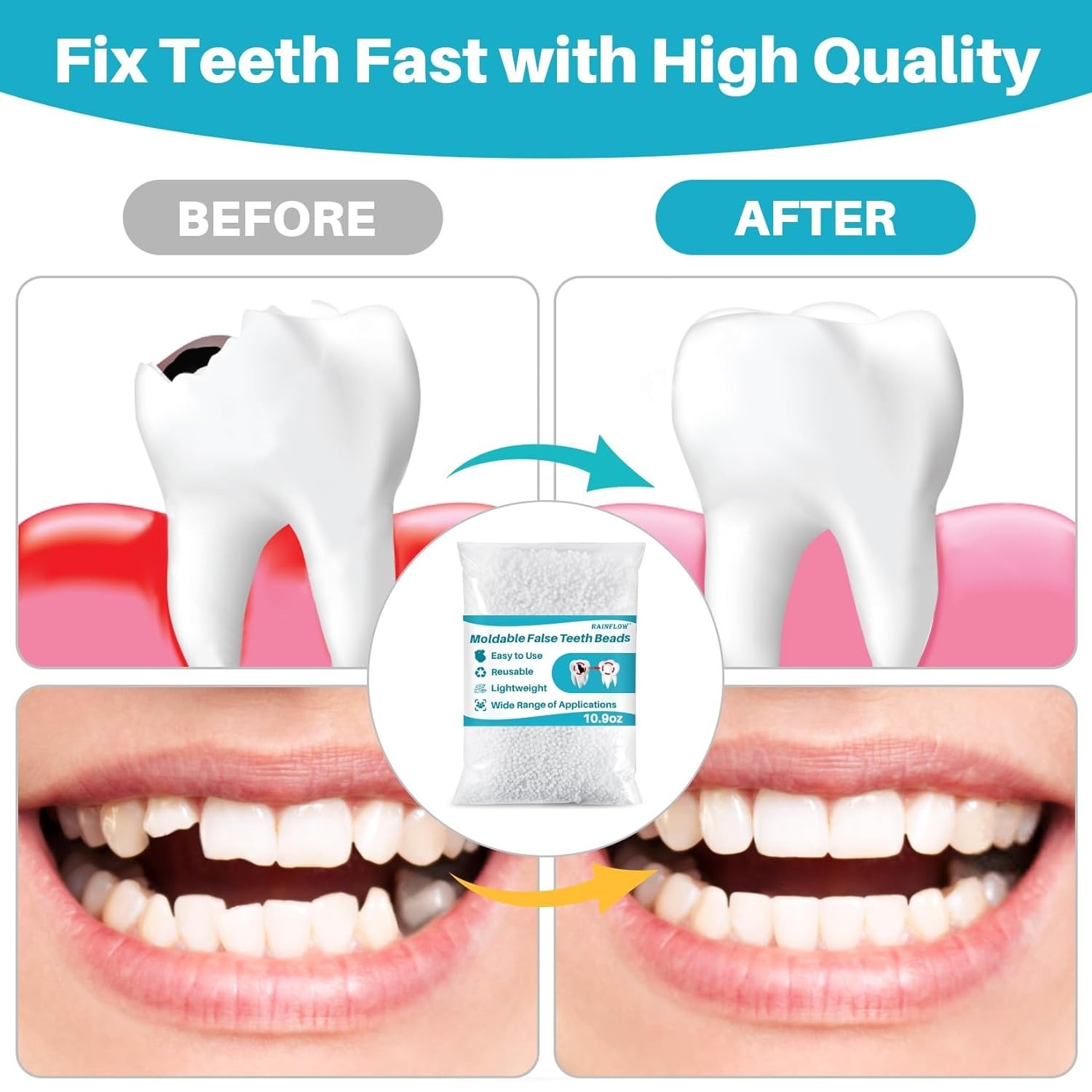 100G Bead Teeth Tooth Solid Gel Replacement Moldable Thermal Fitting Bead Teeth