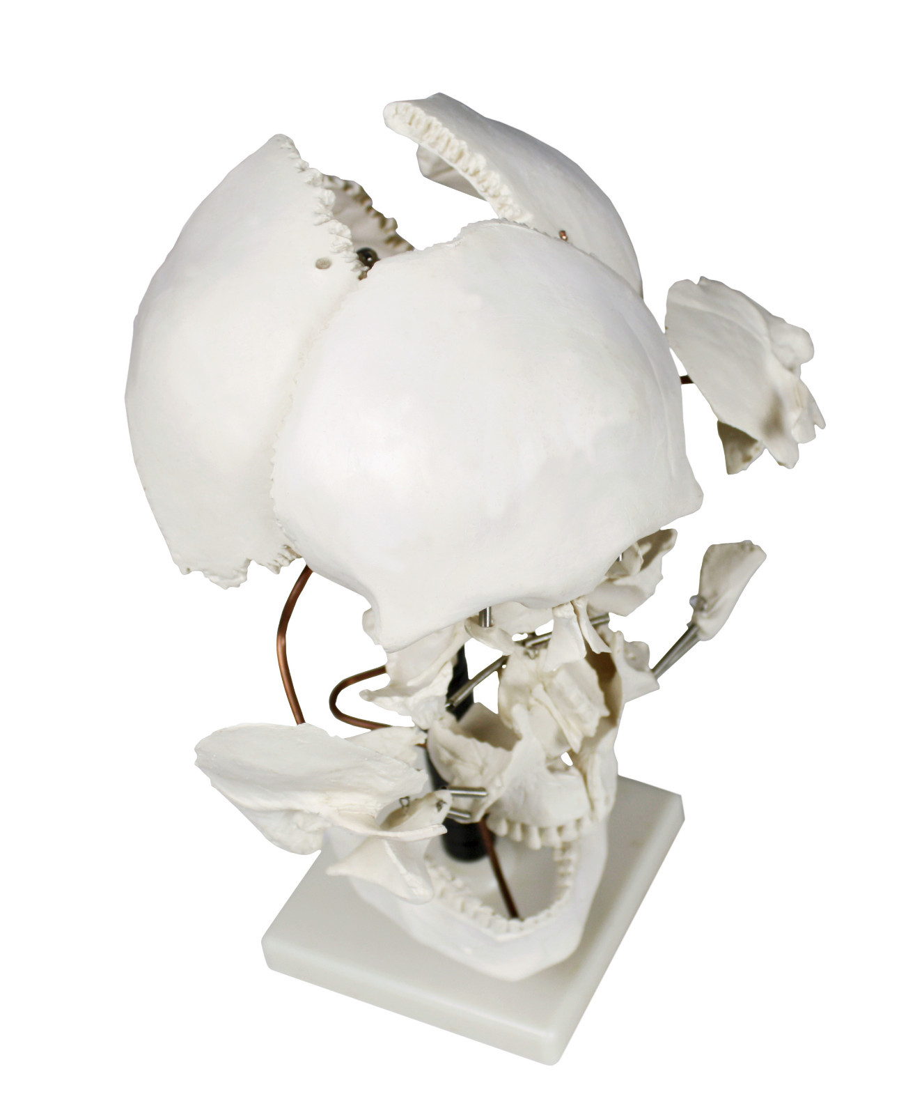 Vision Scientific VAL250-CC3 Beauchene Skull Model With Carrying Case