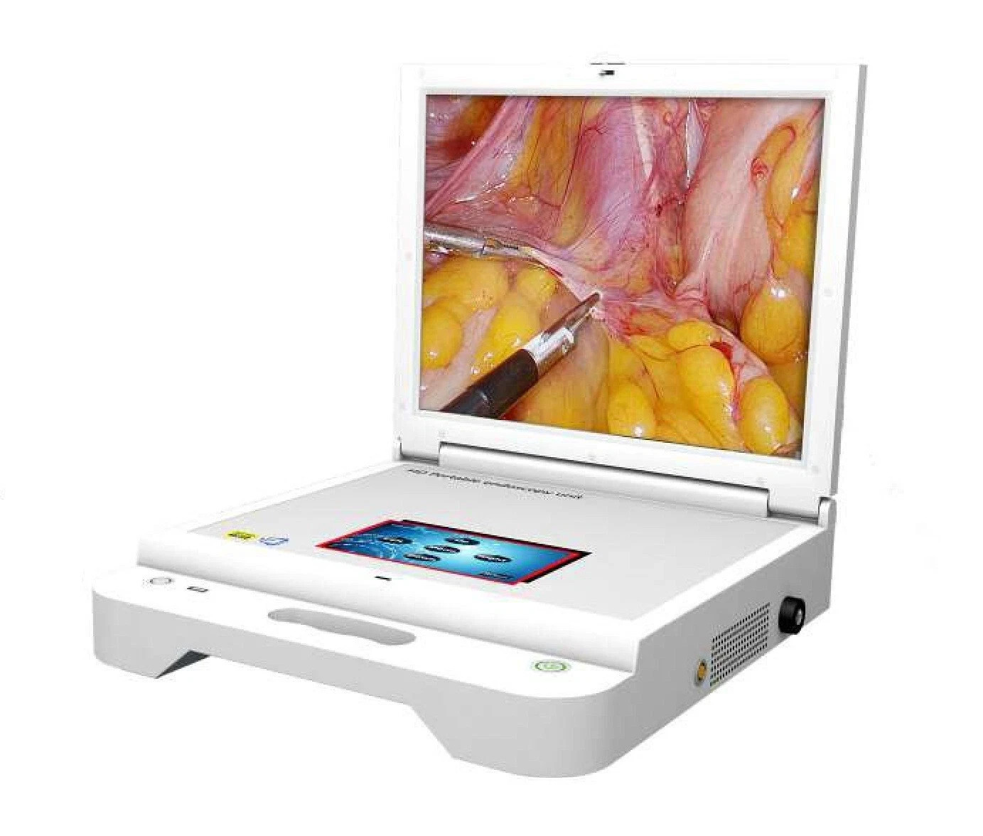 Portable HD Endoscopy Unit (HD Camera) | New