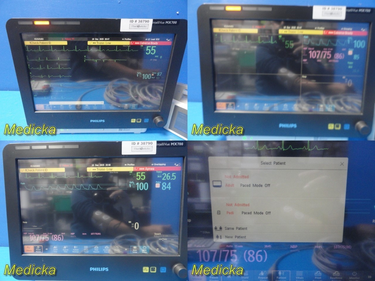 Philips IntelliVue MX700 + X2 (M3002A) + M3012A Monitoring System W/ Leads~38790