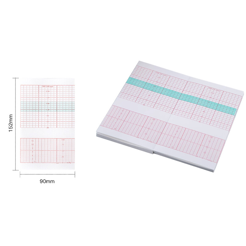 Fetal Monitoring Paper - Edan Fetal Monitor F2/F3/F6/F9 - 150PC/1 Pack