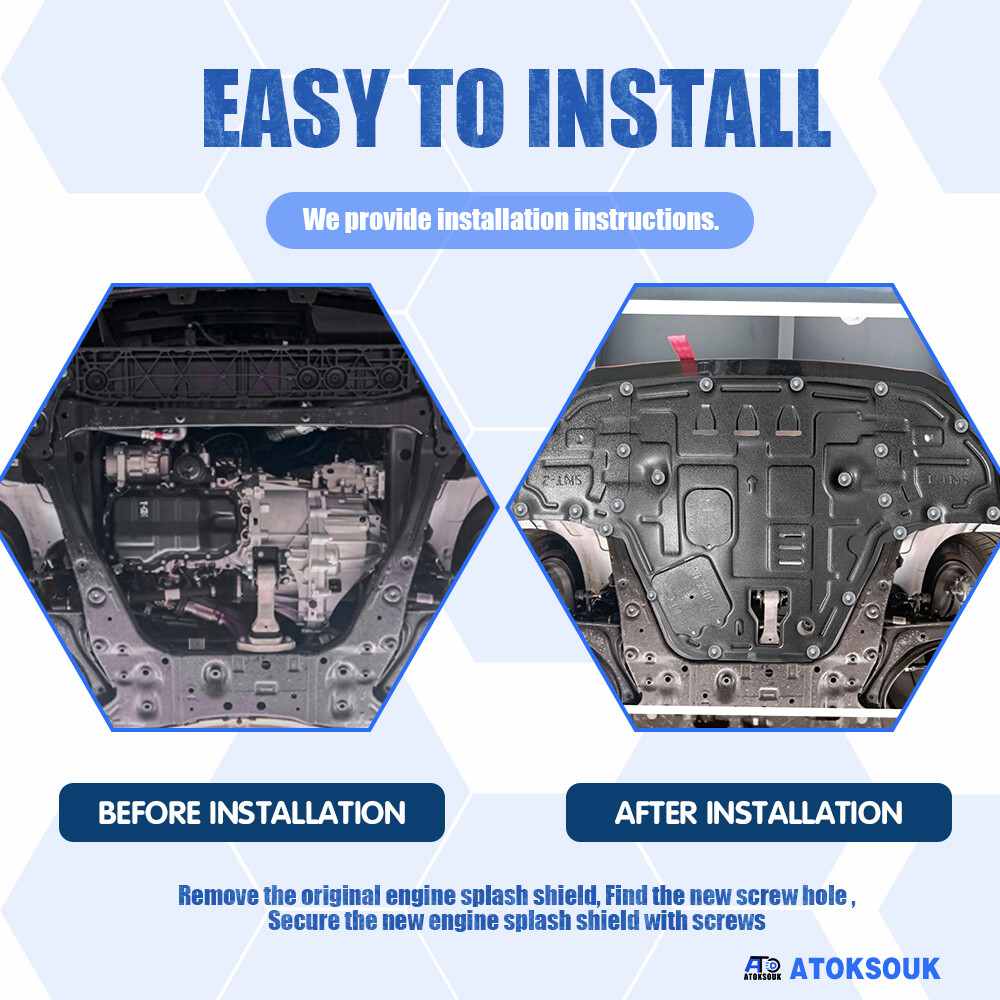 Thick Engine Splash Shield For Hyundai Sonata 2020-2023 Front Engine Guard Hard