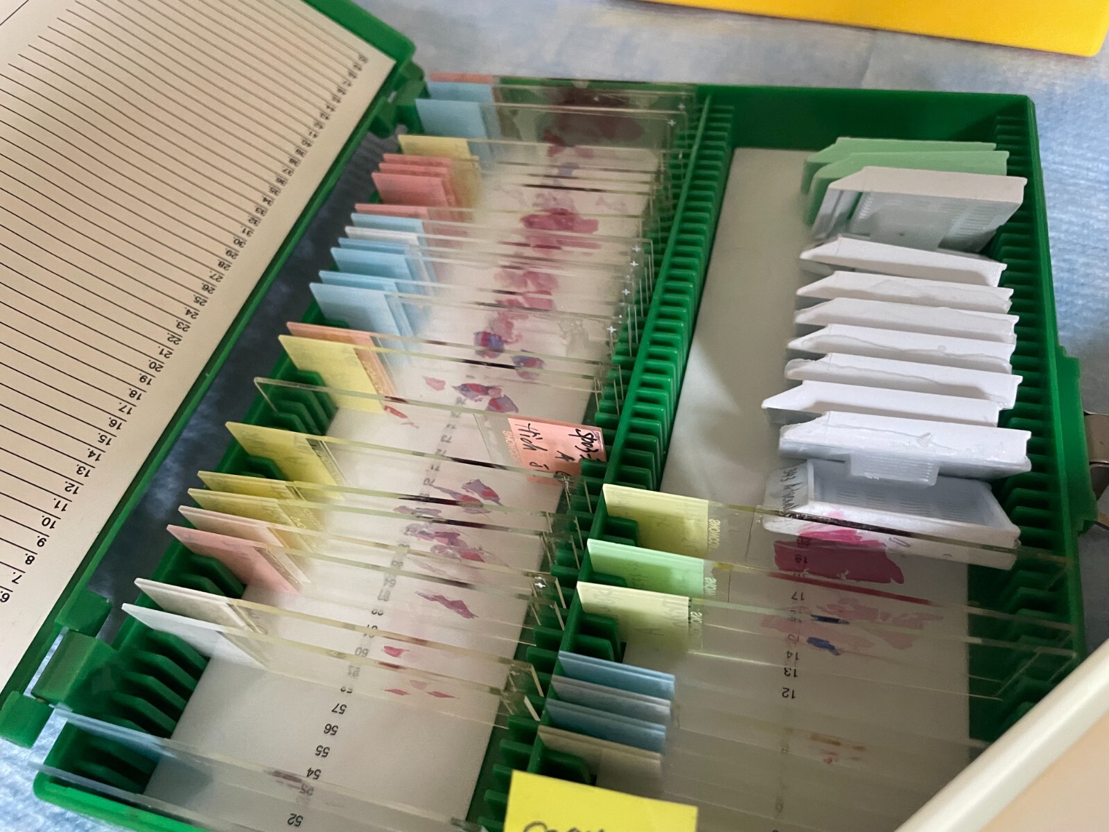 Four Microscope storage boxes with mouse tissues slides, 14,15,16,17