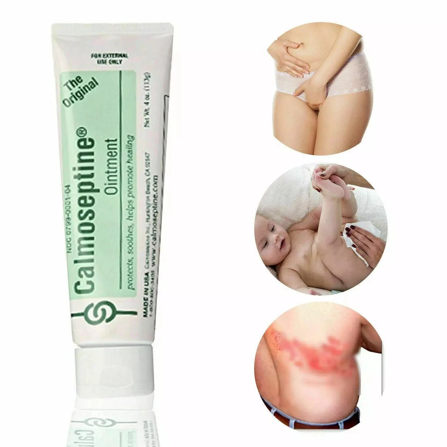 Crema Para Infecciones Vaginales Elimina Hongos Picazon Irritación Pomada Vagina