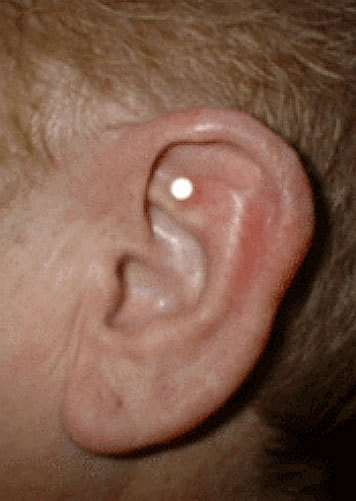 Work Stress Relief Ear Magnets 1 New Kit 2026 Success