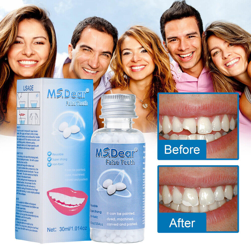 2× Tooth Repair Kit, Temporary Teeth Replacement Kit for Missing & Broken Teeth