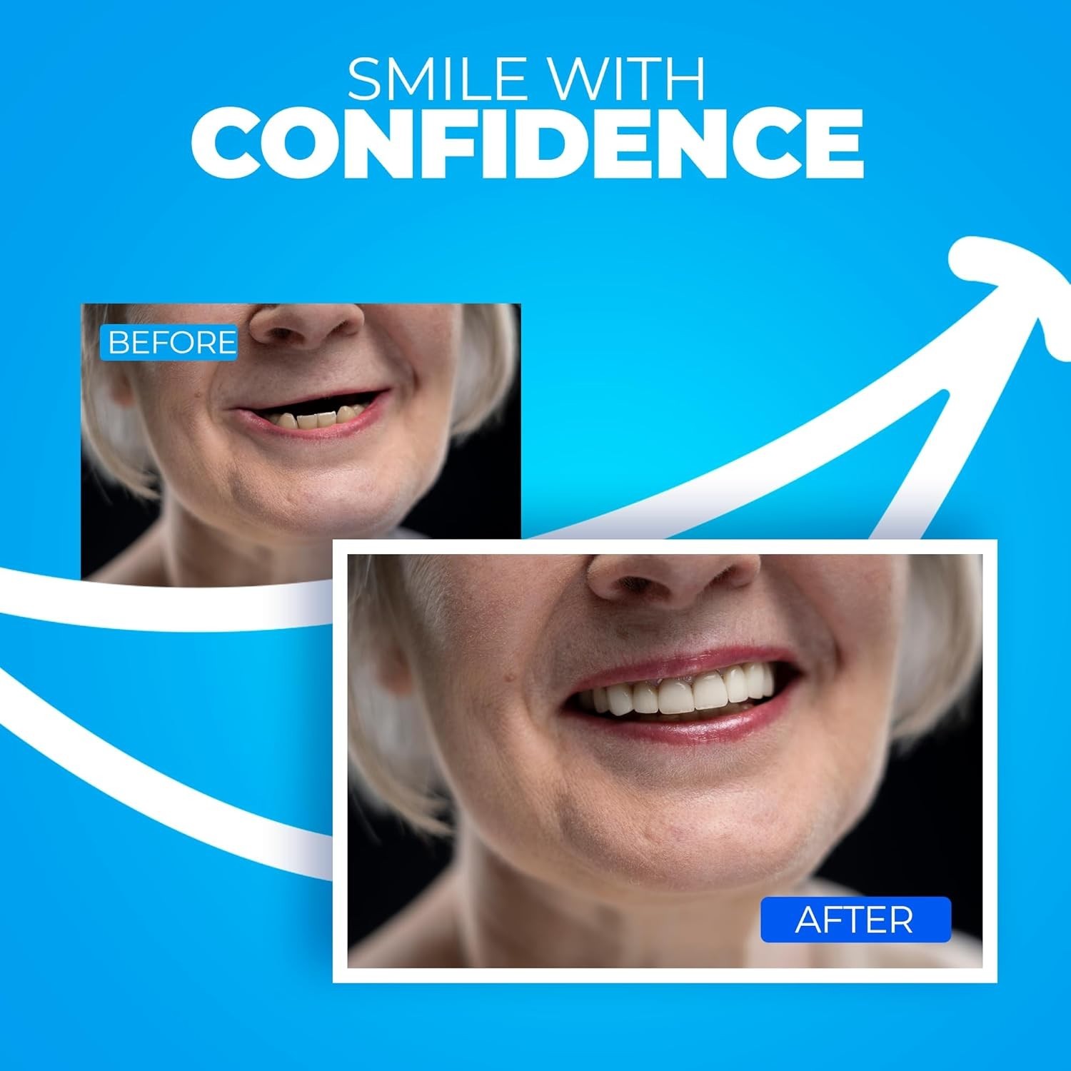 Personalized Upper and Lower Dentures - Home Solution Kit with 12 Durable Pieces