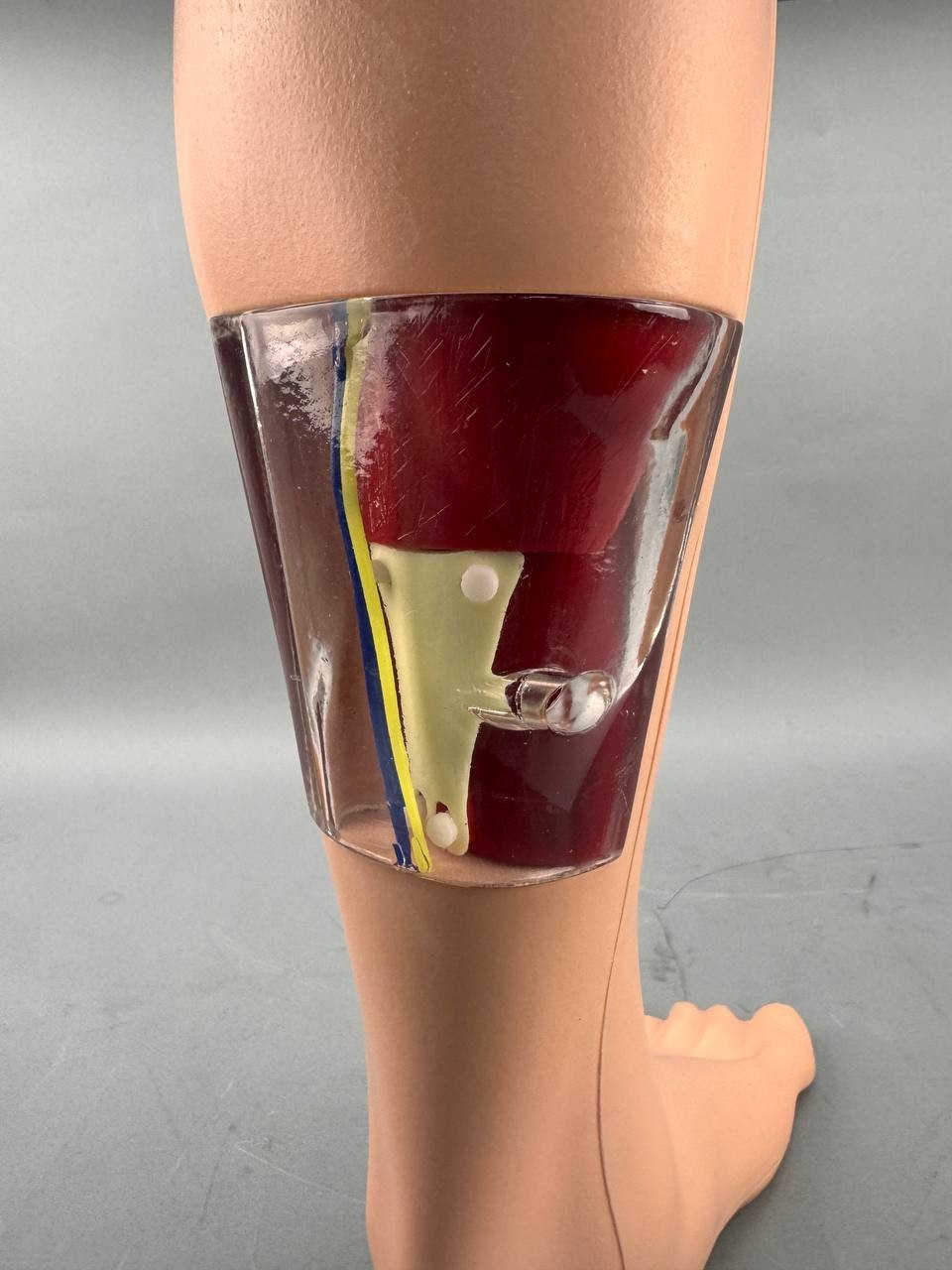 MicroAire Smart Release W/ Leg and Case