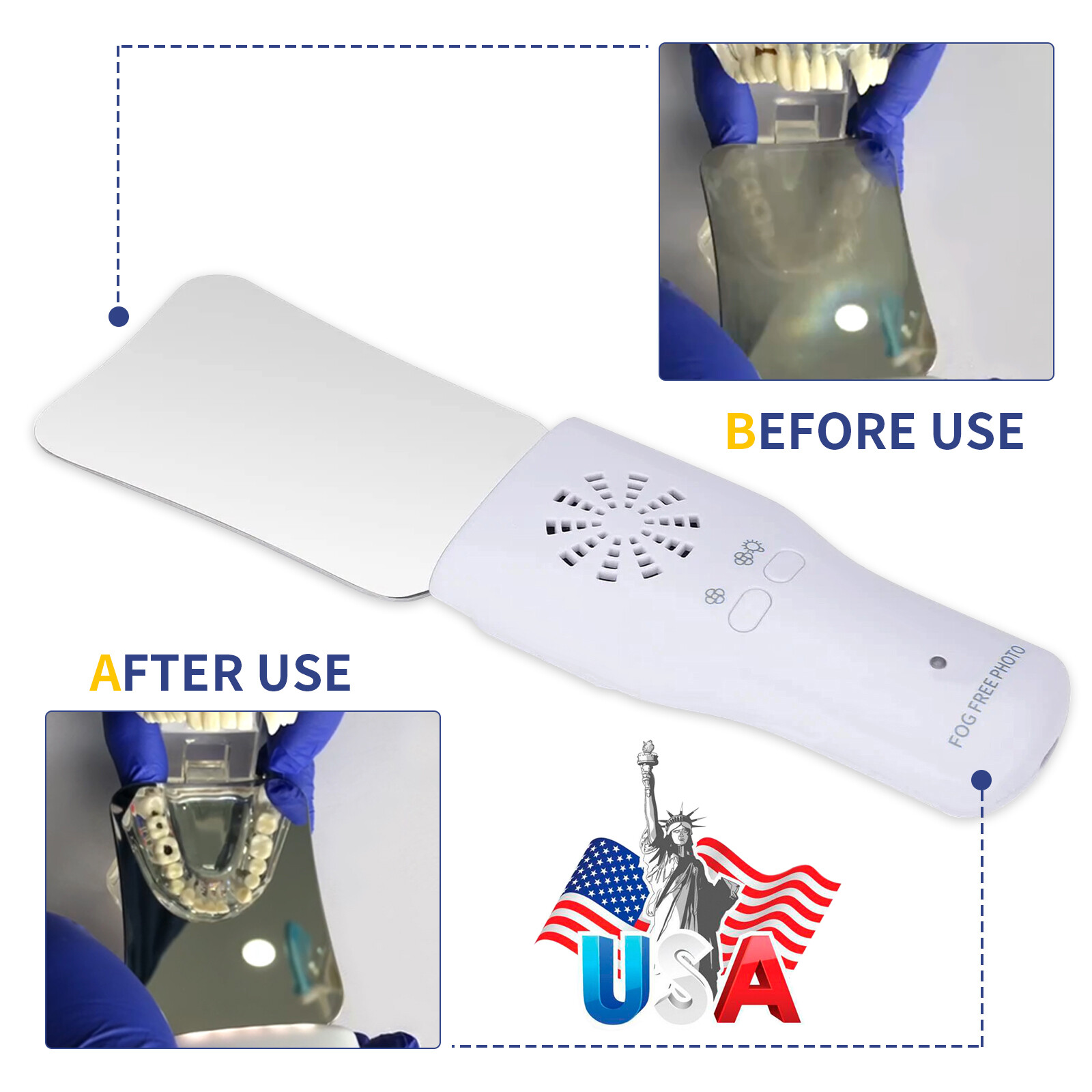 1-10 Dental Occlusal Mirror Fog Free LED Intra Oral Photo Mirror Reflector