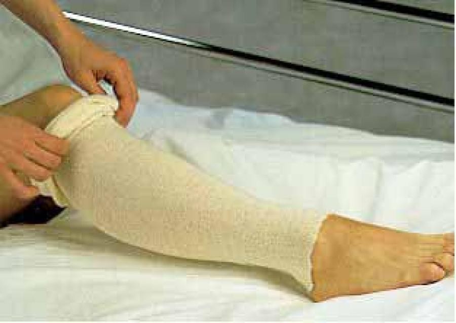 Albahealth Off-White Tubular Stockinettes Off-White 4"x25 Yd Tubular Plaster, 1
