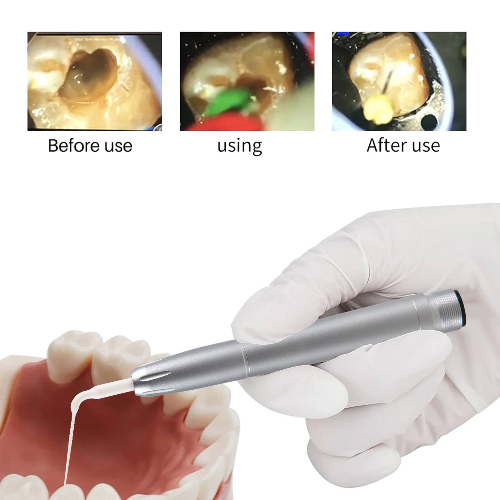 Dental Air Scaler Handpiece 5 Endo Irrigation Tips Compatible with KAV 2Hole DL