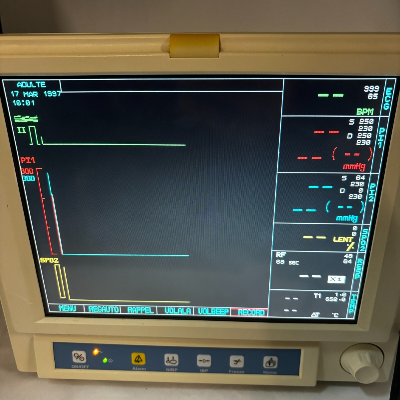 LARSEN & TOUBRO STAR 50 PATIENT MONITOR MODEL 2000 CLASS 1 50/60HZ STAR50 🎯