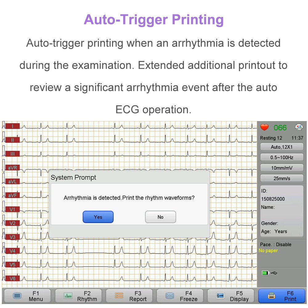12 channel ECG Machine with interpretation for advisory diagnosis FDA approved