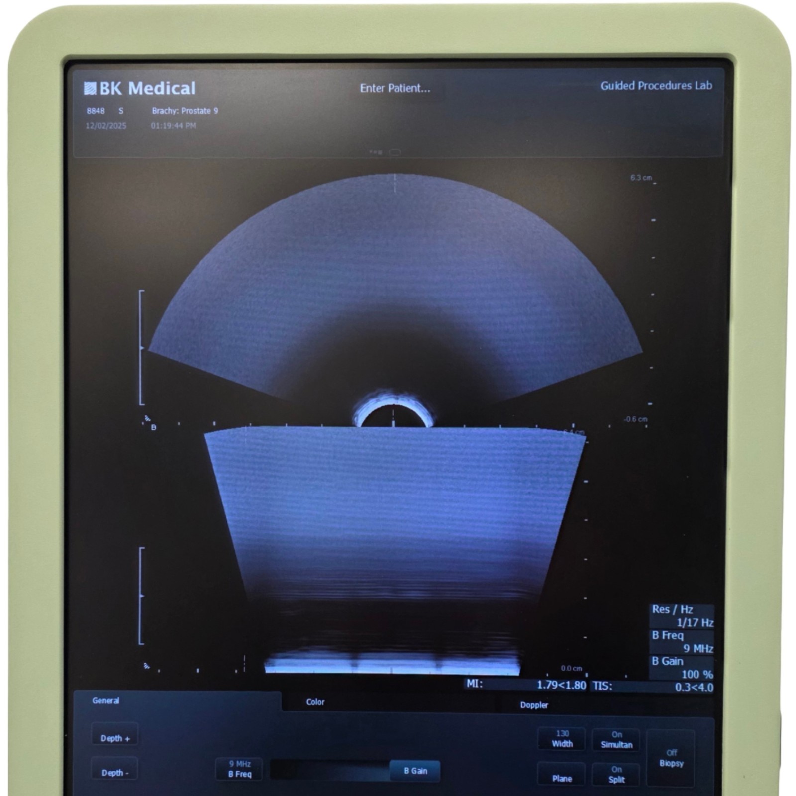 BK Medical Type 8848 Endocavity Biplane Transducer Probe 12-4MHz, *Dropout*
