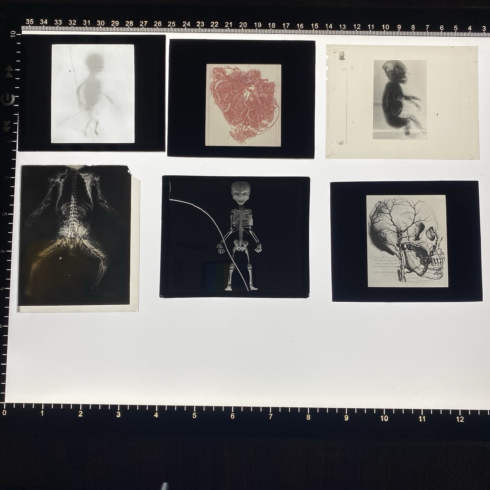 Antique Medical Anatomy Research Slides Fetus Skeleton Oddities Macabre Curio