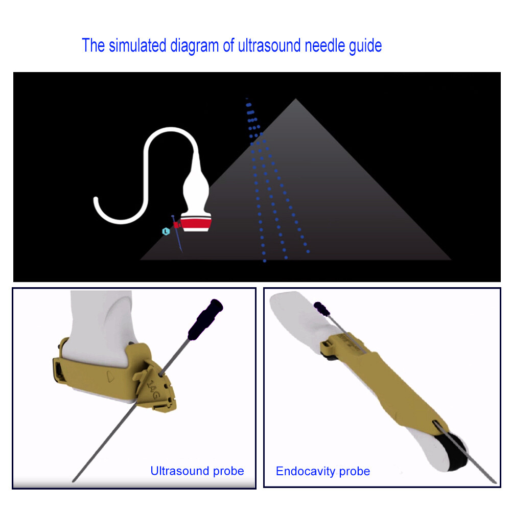 Ultrasonix C5-2/60 Stainless Steel Biopsy Needle Guide, Warranty: 12 months,