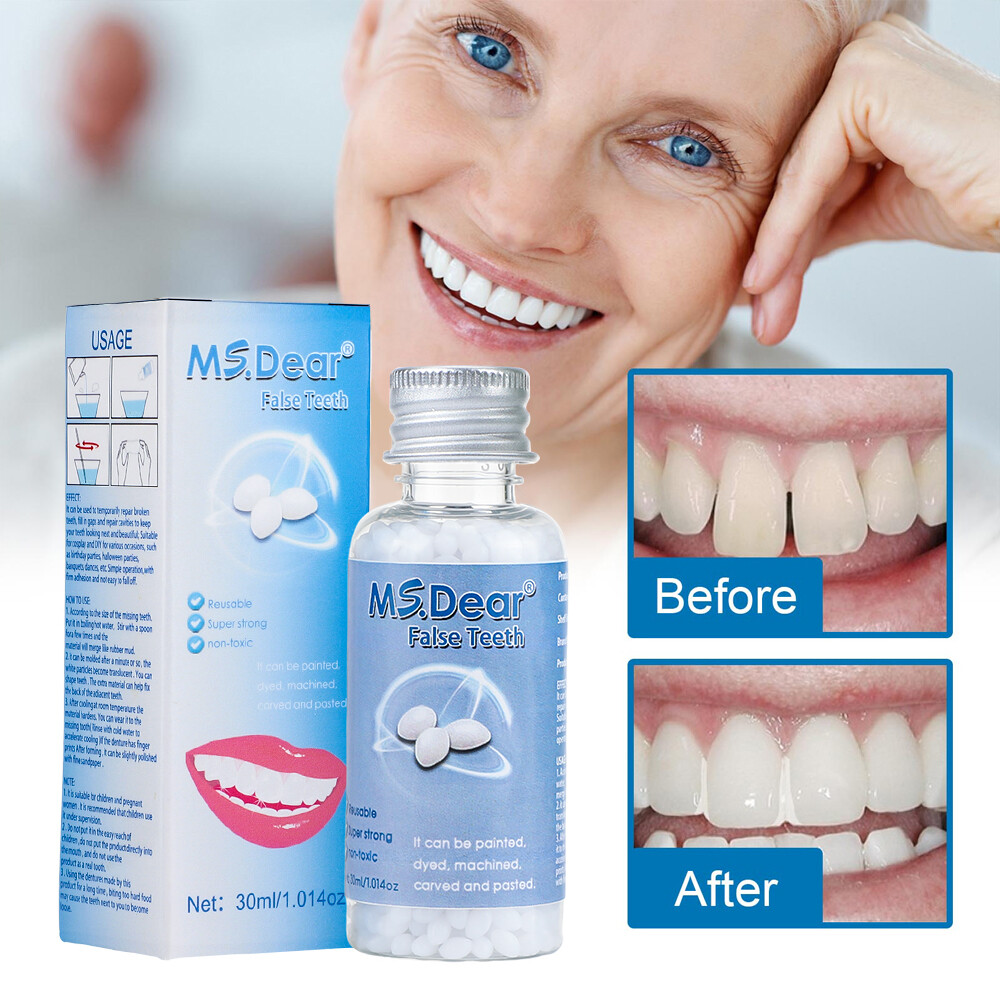 2X Tooth Repair Kit - Temporary Teeth Replacement Kit for Missing & Broken Teeth