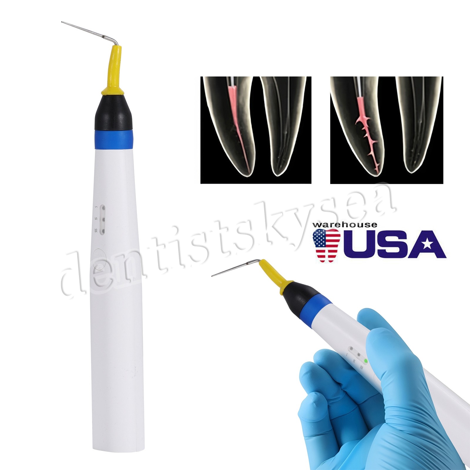 5Pcs Cordless Gutta Percha Obturation System Endo Heated Pen With 2 Tips