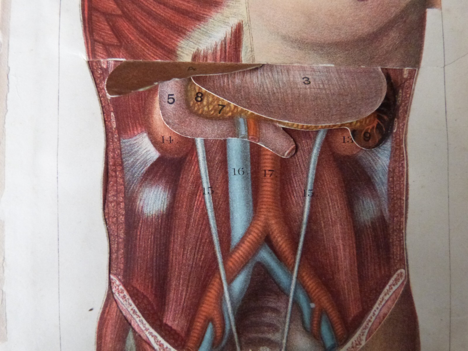 1880s HUMAN BODY FOLDOUT - DISSECTION - CHEST & ABDOMEN - SEE DESCRIPTION