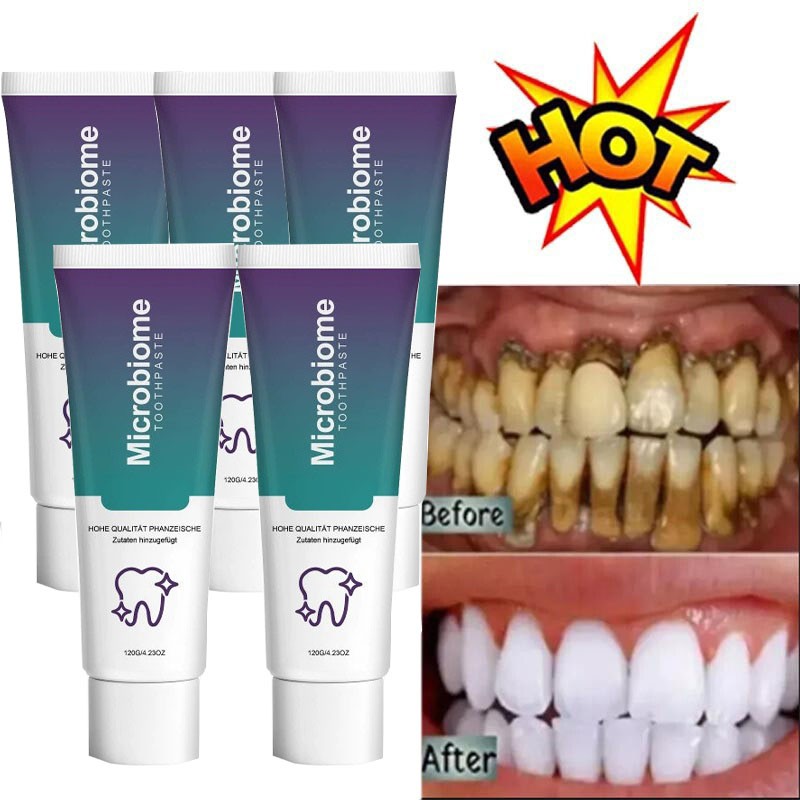 5X Microbiome Mint Flavor Gum Toothpaste Cleaning Toothpaste Sensitive Teeth