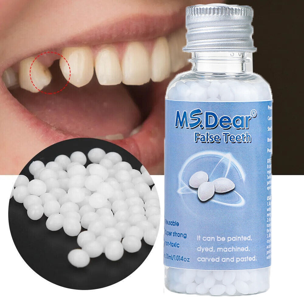 2× Tooth Repair Kit, Temporary Teeth Replacement Kit for Missing & Broken Teeth