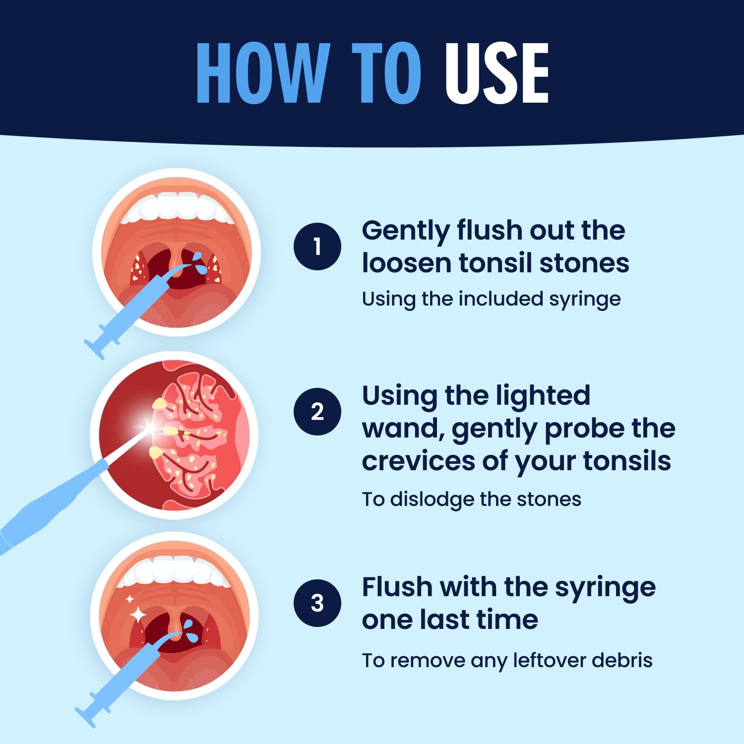 Dr. Frederick’S Original Easy Tonsil Stone Remover Kit - Fast Painless Tonsillol