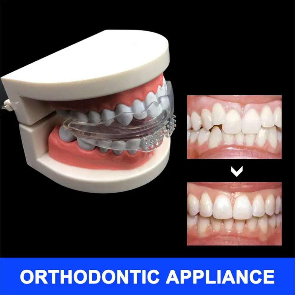 Orthodontic Silicone Braces Teeth Aligner Trainer for Dental Care 1PC\