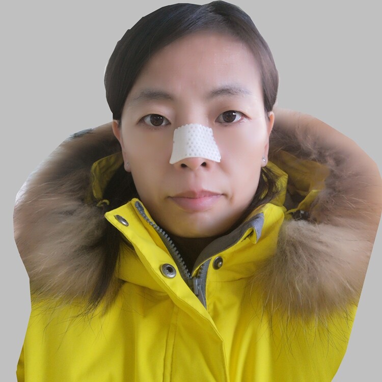 External Thermoplastic Nasal Splint for Rhinoplasty 2.0mm 100pcs