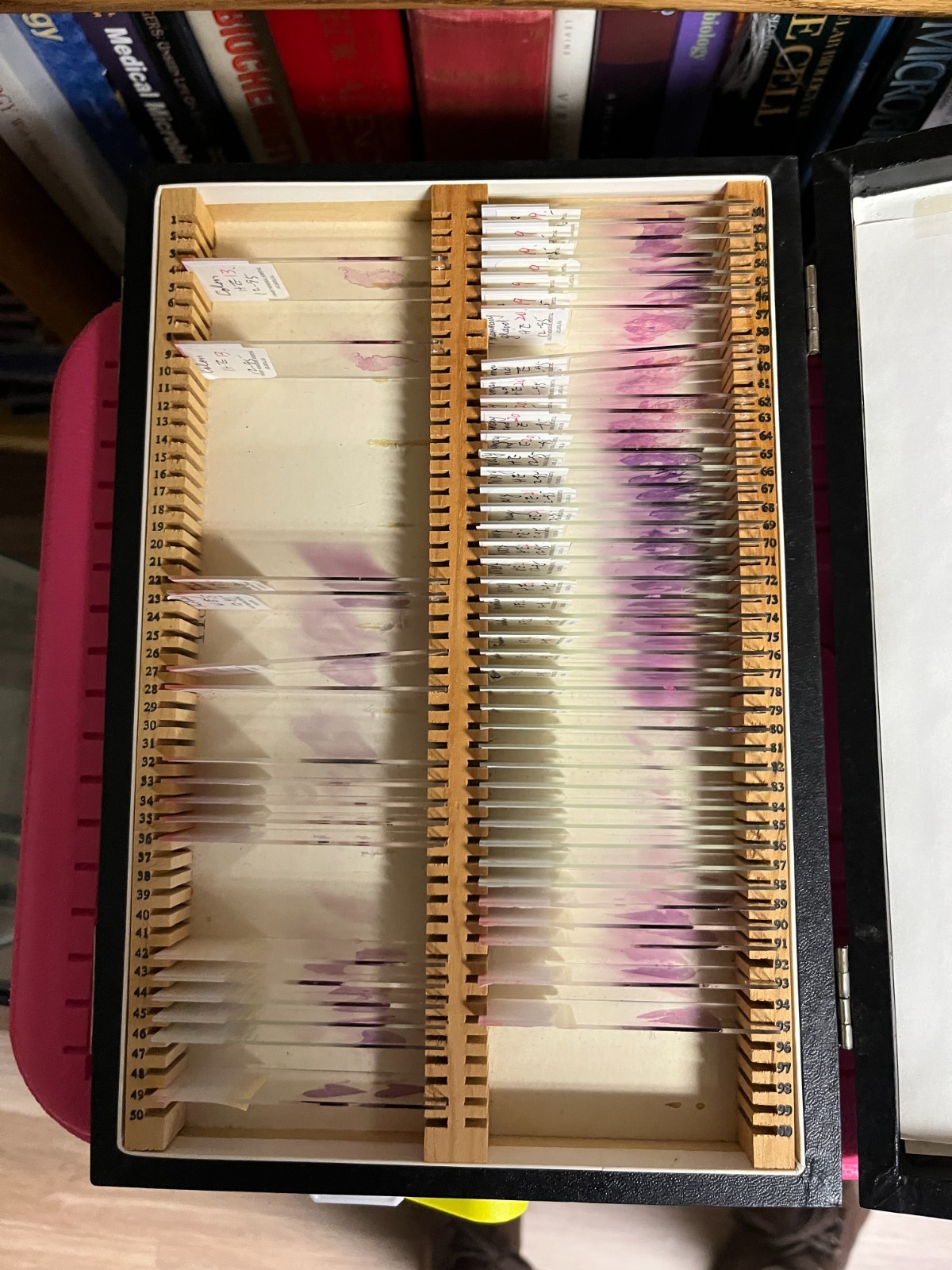 Vintage Human Histology Slides, H & E stain from in wooden case