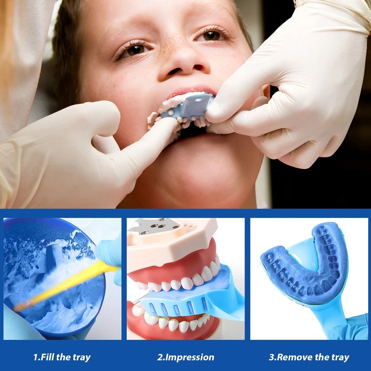 10 Pc/Set Dental Disposable Plastic Impression Trays Blue Plastic Denture