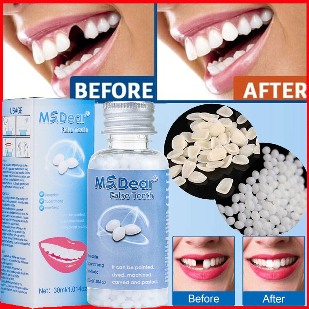 Tooth Repair Kit - Temporary Teeth Replacement Kit for Missing & Broken Teeth US