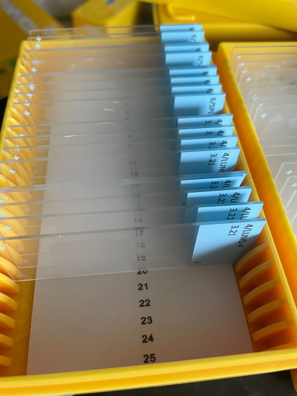 Microscope storage boxes with mouse tissues slides