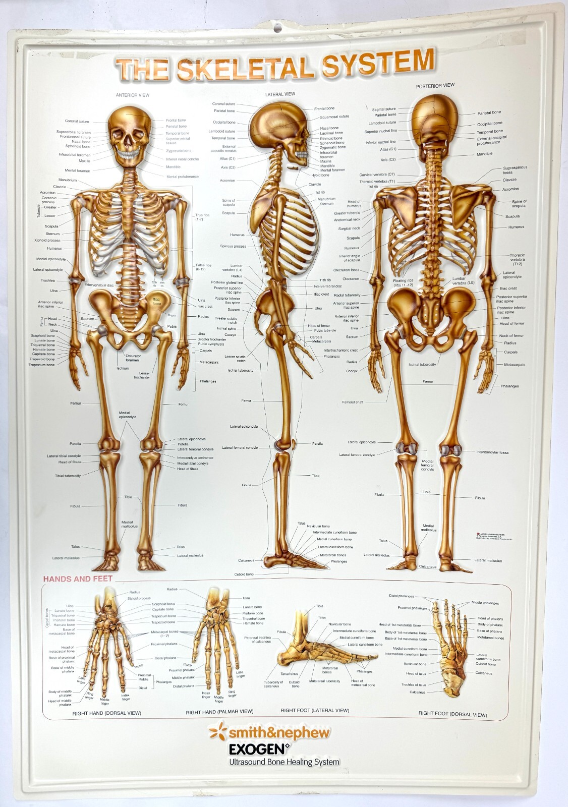 Vintage Cast Plastic Exogen Smith&Nephew Ultra Sound Skeletal System 3D Poster