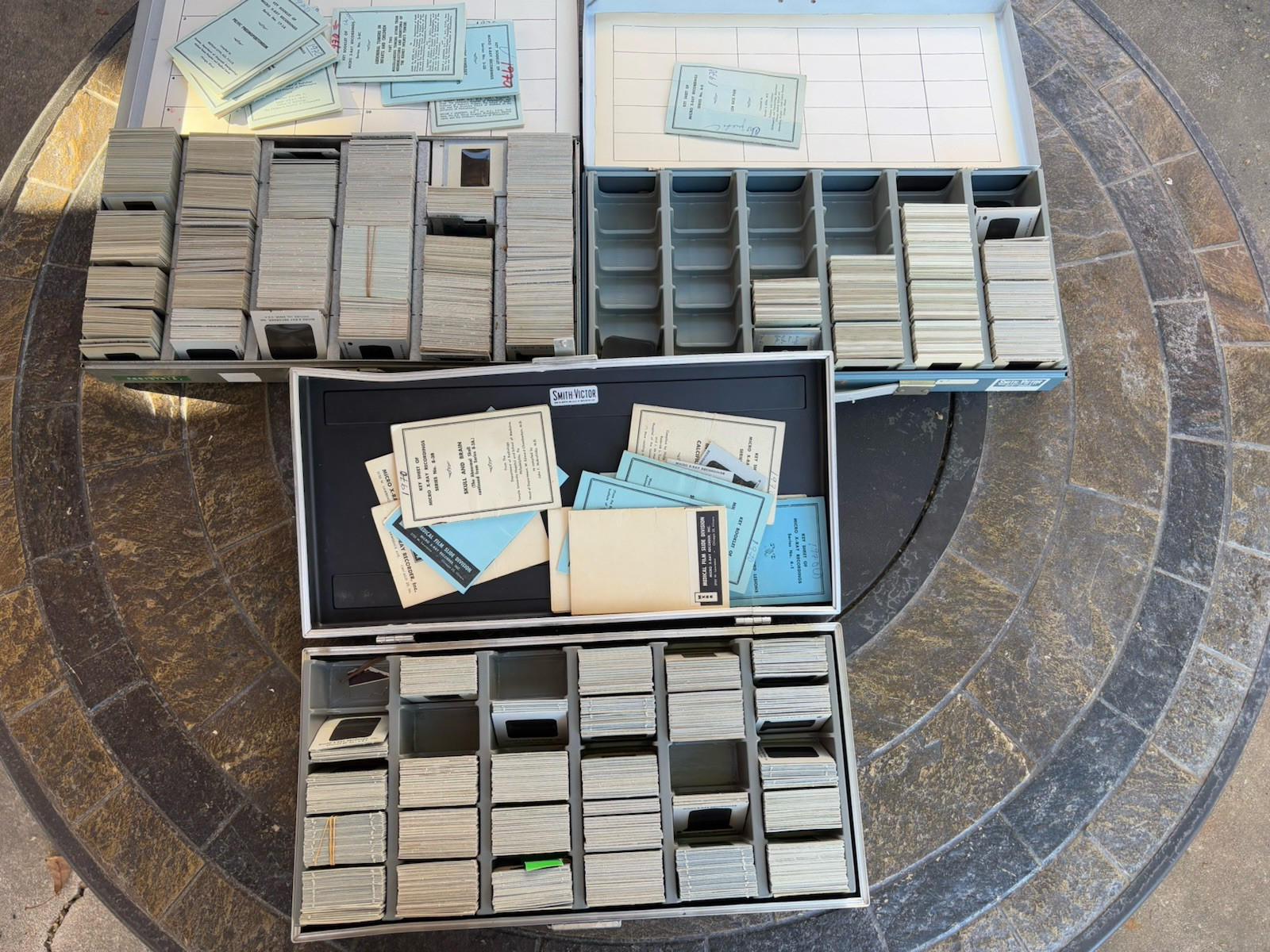 Vintage Set of 100’s of Medical Negatives Skull Intestines Pediatrician Skeleton
