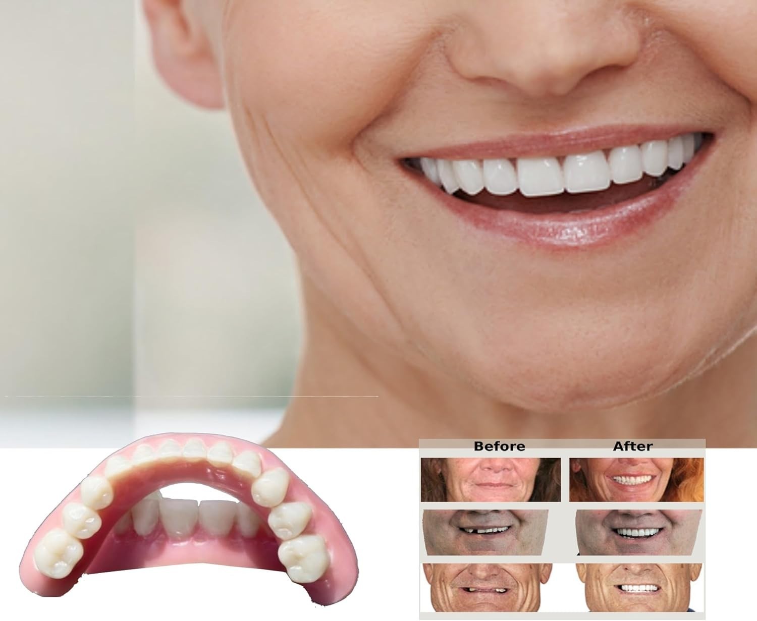 DIY Denture Kit with Impression, Do-It-Yourself Partial Denture Solution, Small