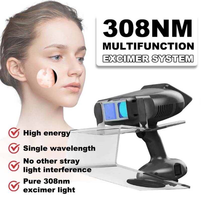 308nm Psoriasis Excimer Laser Uvb Light Therapy Laser Treatment Machine ﻿