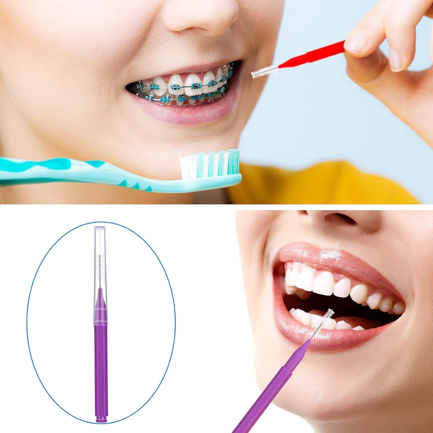 Patelai 100 Pieces Braces Brush for 1 Count (Pack of 100), Classic Colors